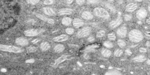 Transmission electron micrograph of mitochondria in corneal endothelial cells