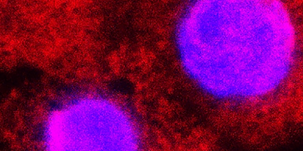 Confocal microscopy of corneal endothelial cell nuclei (pink) and mitochondria (red)